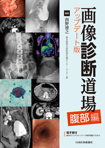 できるゾ読めるゾ 腹部エコー