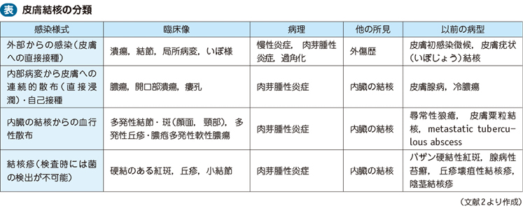 皮膚結核 – 日本医事新報社