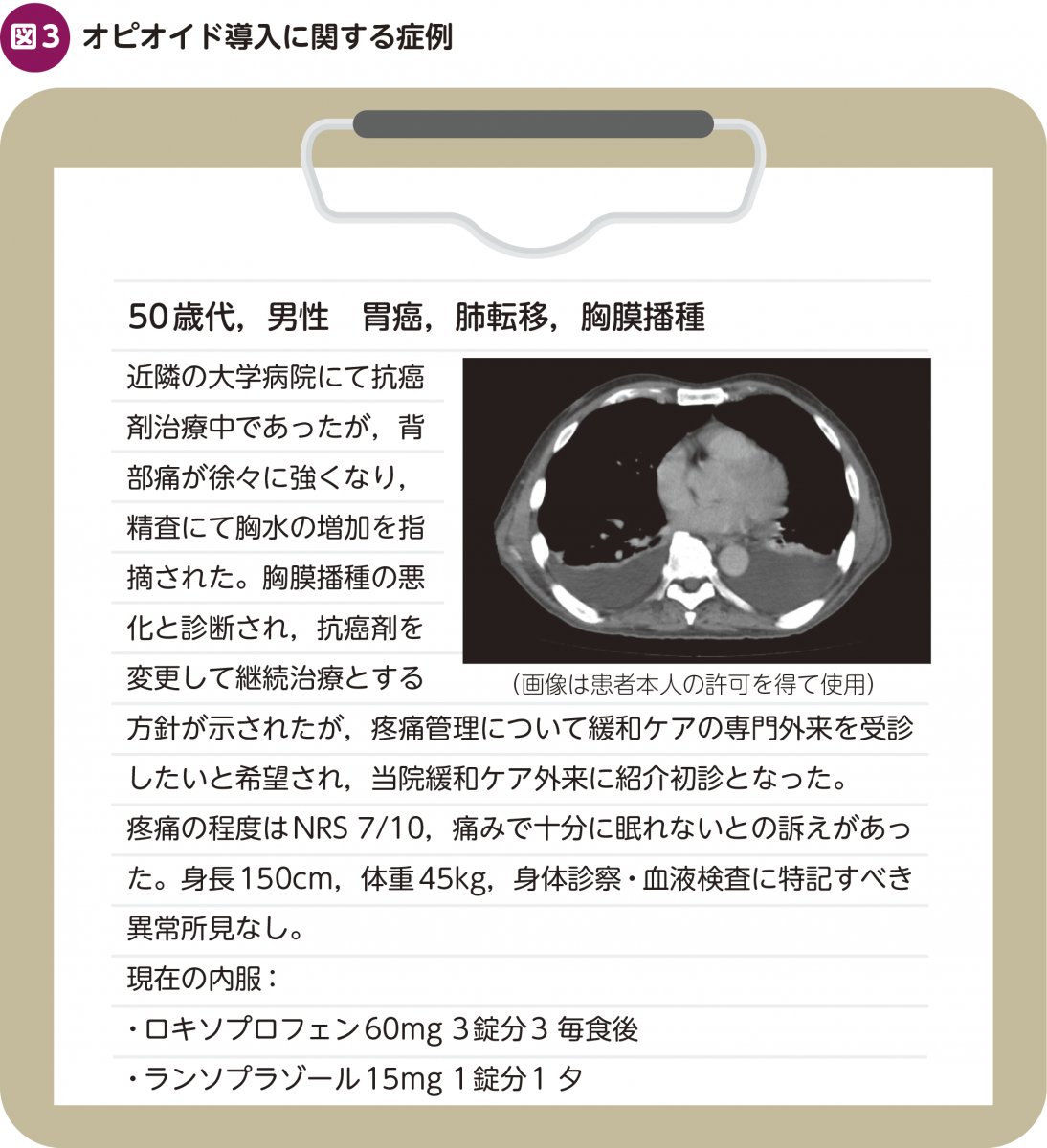 FOCUS：〈キャラクターで理解する〉 鎮痛薬処方の方程式 – 日本医事新報社