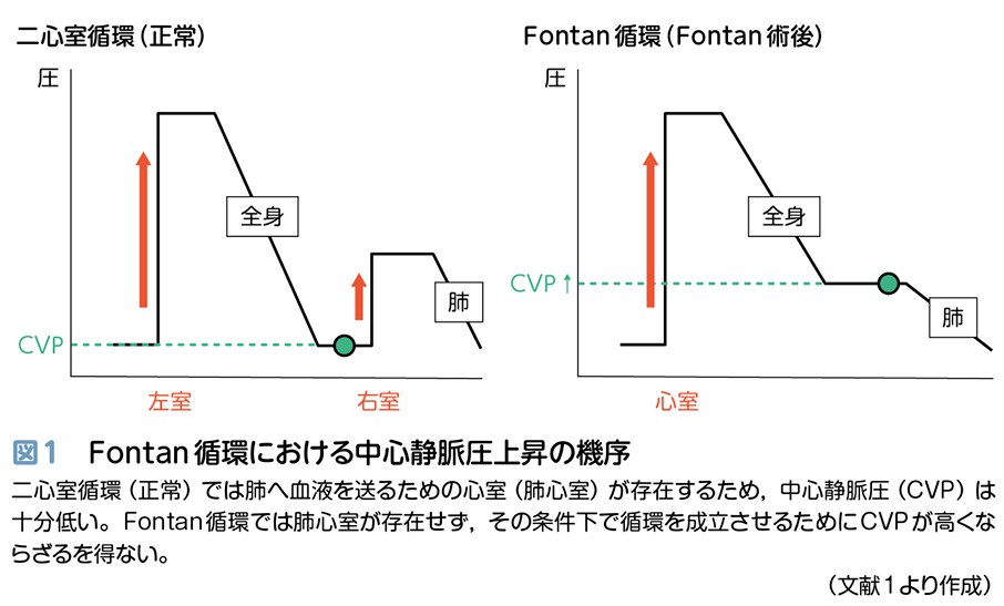 中学2年生女性の入院拒否 ～Fontan術後遠隔期の問題点～【小児循環器