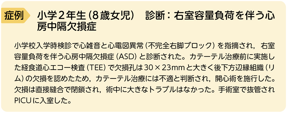 【裁断済】小児循環器入門 小児循環器入門 | 増谷聡, 平田陽一郎 |本 | 通販 | Amazon