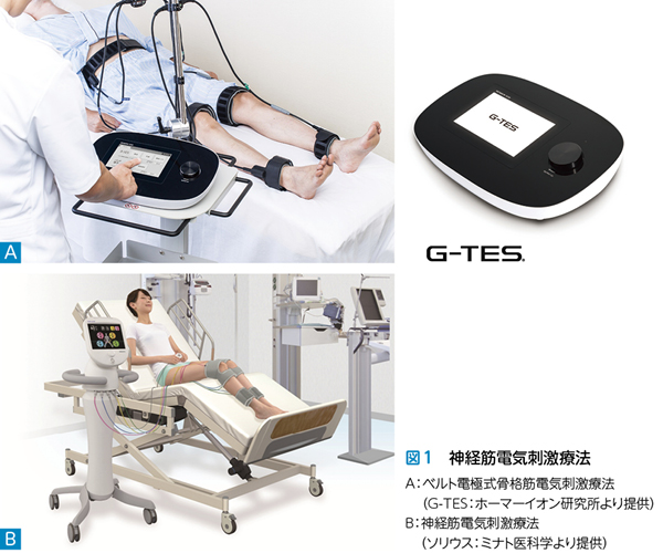 第2章 PICSの予防と早期介入のポイント 5. 神経筋電気刺激療法