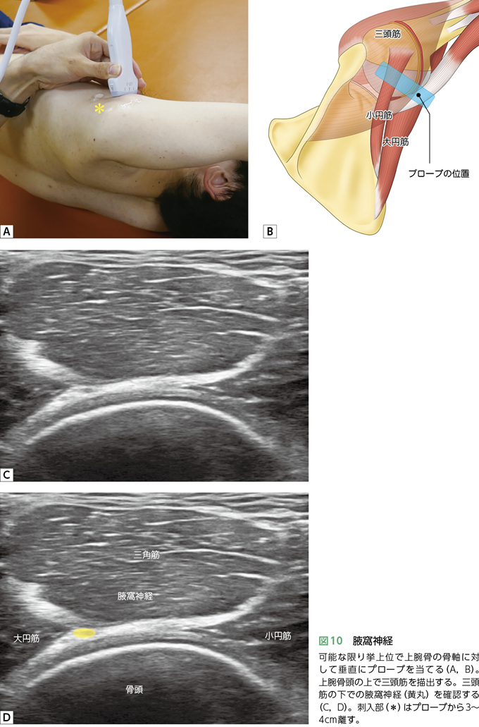 2章-13：肩痛を有するスポーツ選手の末梢神経障害 – 日本医事新報社