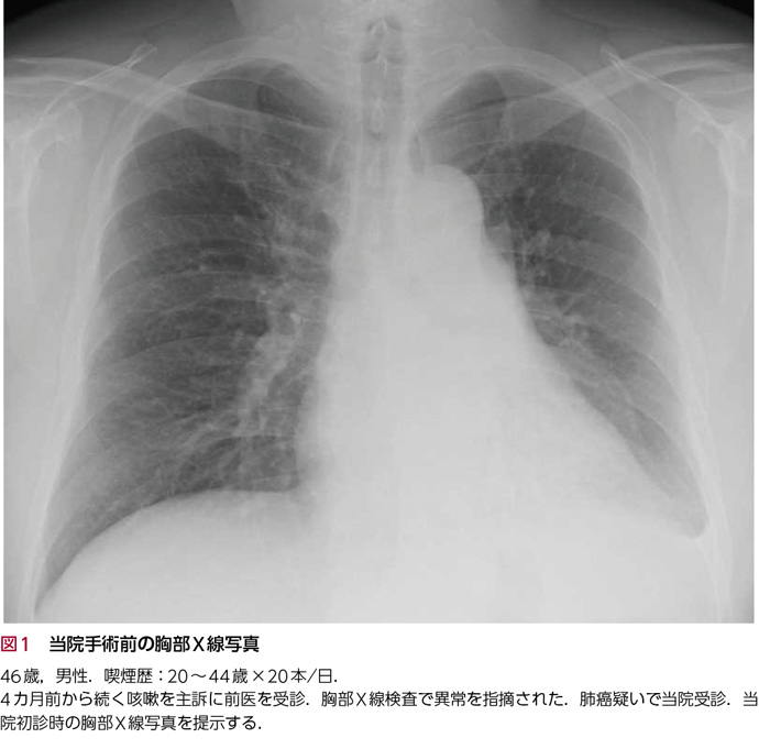 11）胸部X線 読影セミナー – 日本医事新報社