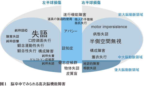 2）脳卒中による高次脳機能障害 ［特集：脳卒中リハビリの今］ – 日本