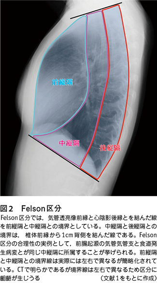 1）縦隔の解剖学的区分と正常像［特集：縦隔腫瘍 診断の進め方