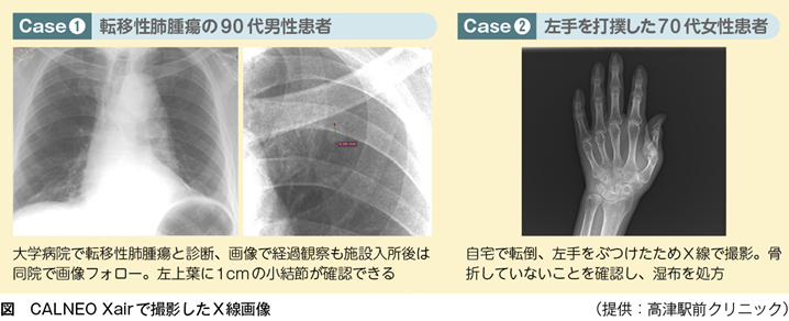 軽量携帯型X線装置の活用で入院のベッドサイドと遜色ない訪問診療を