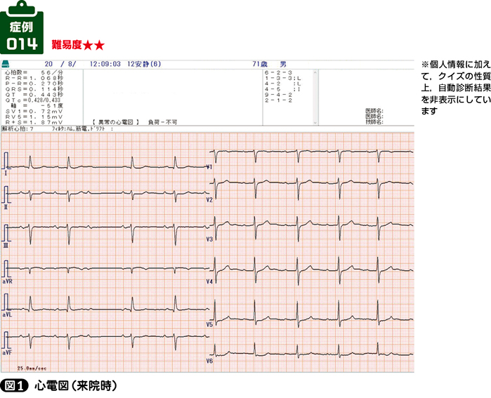 不整脈 自由が丘内科循環器科クリニック｜不整脈｜めまい 立ちくらみ