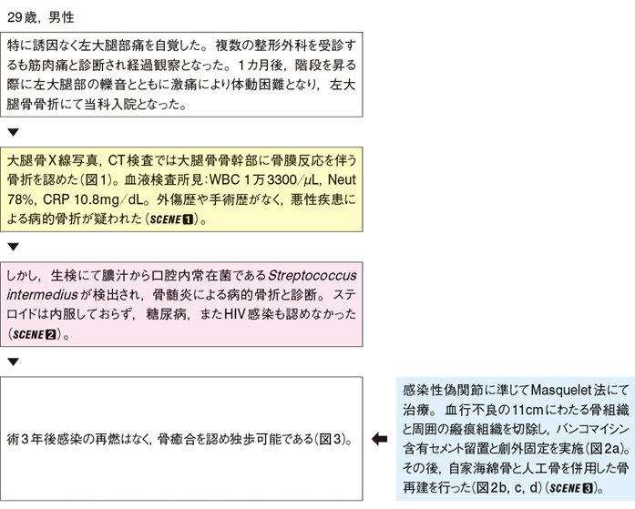 左大腿骨病的骨折［難渋症例から学ぶ診療のエッセンス（99）］ – 日本