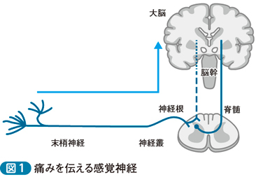 神経障害性疼痛─解剖学的アプローチ［直感で始める診断推論（5