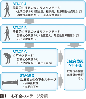 心不全の薬物治療─収縮機能障害HFrEFを中心として［J-CLEAR通信（136