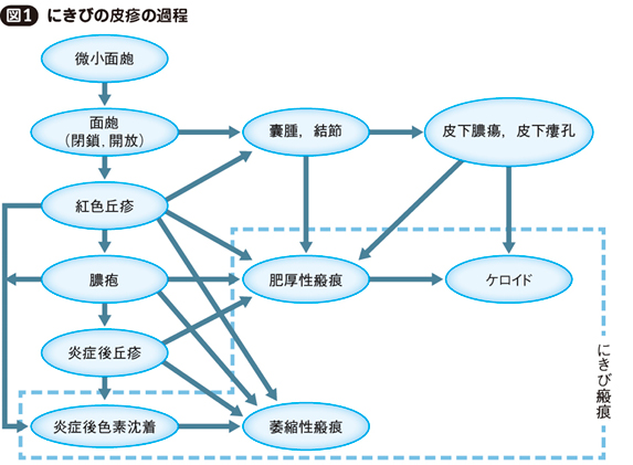①面皰