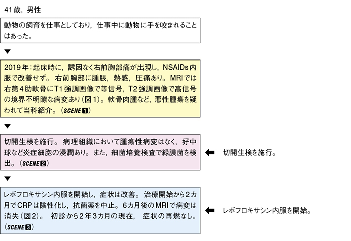 化膿性胸肋関節炎［難渋症例から学ぶ診療のエッセンス（142）］ – 日本