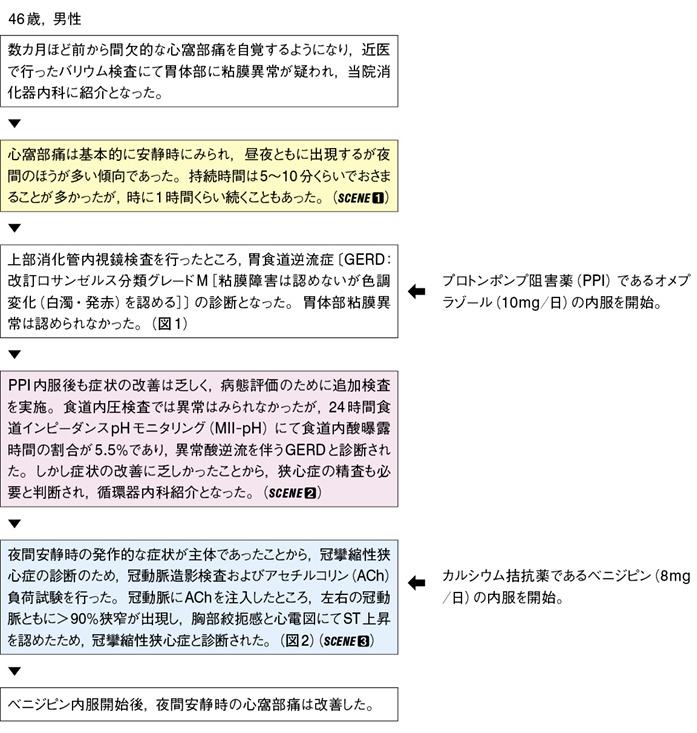 胃食道逆流症と冠攣縮性狭心症を合併した心窩部痛［難渋症例から学ぶ