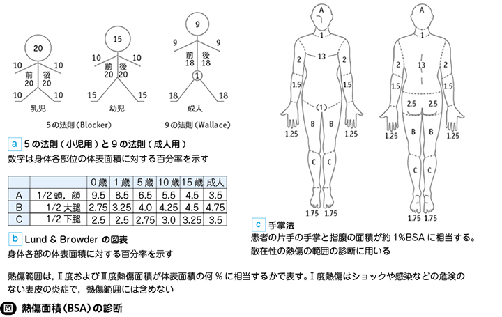 熱傷［私の治療］ – 日本医事新報社