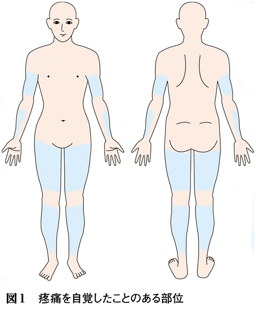 発作性の四肢痛を主訴に受診した18歳女性［キーフレーズで読み解く