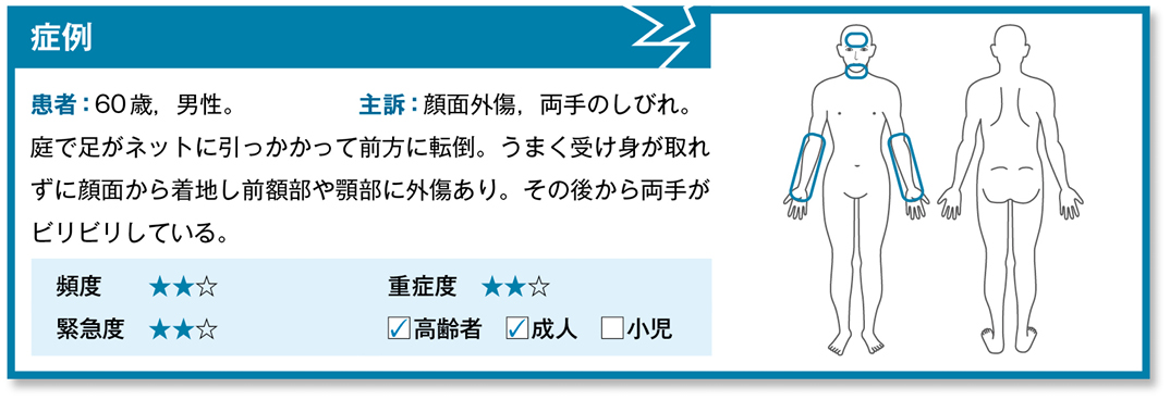 顔面をケガして両手がビリビリする……［中心性脊髄損傷］［骨折