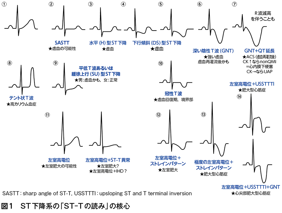 プレミアム会員向けコンテンツです(連載の第1~3回と最新回のみ無料会員も閲覧可)